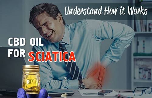 CBD Oil for Sciatica