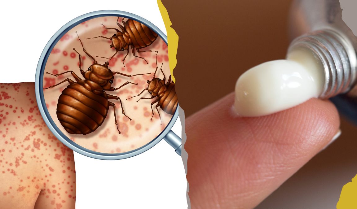 Best Bug Bite Ointments Red Storm Scientific